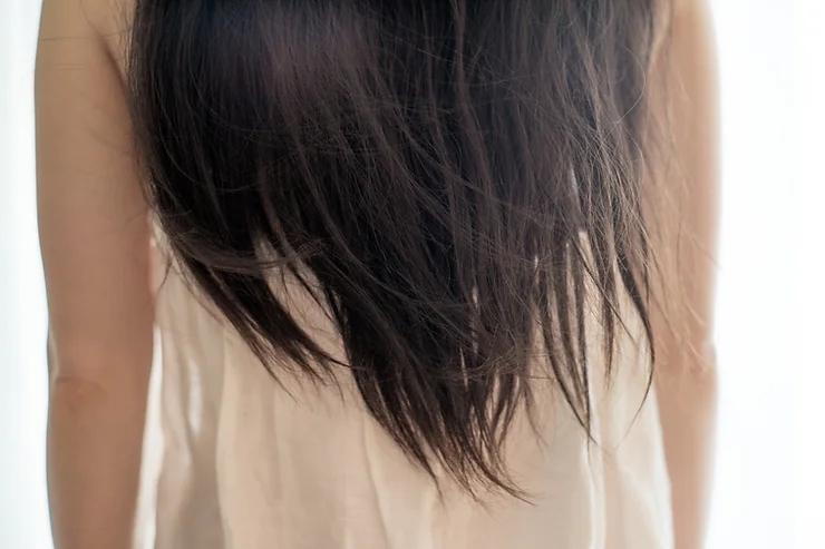 Rụng tóc bất thường: Có phải do căng thẳng quá mức?